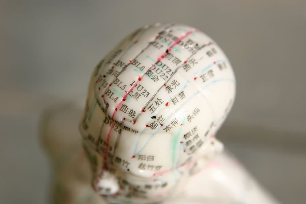 acupuntura craneal en zaragoza