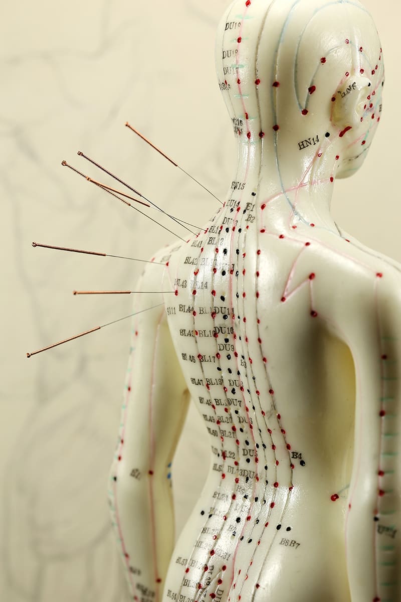 acupuntura-microsistemas acupuntura zaragoza