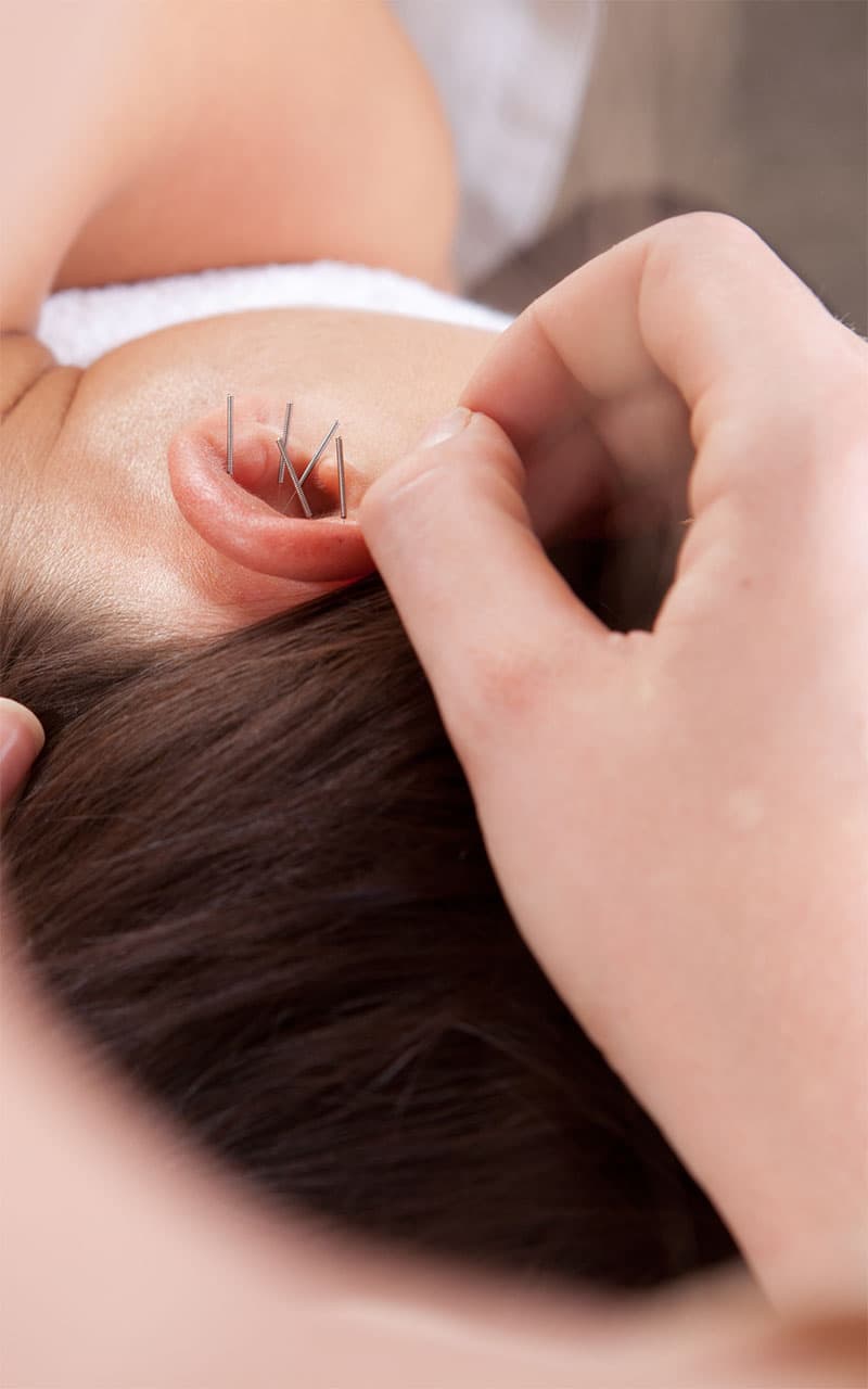 terapia auriculoterapia zaragoza