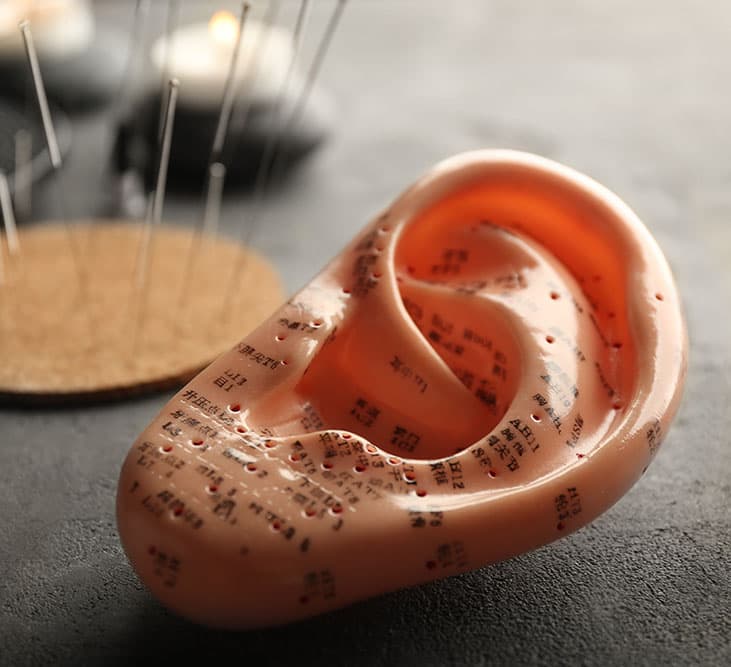 auriculoterapia zaragoza