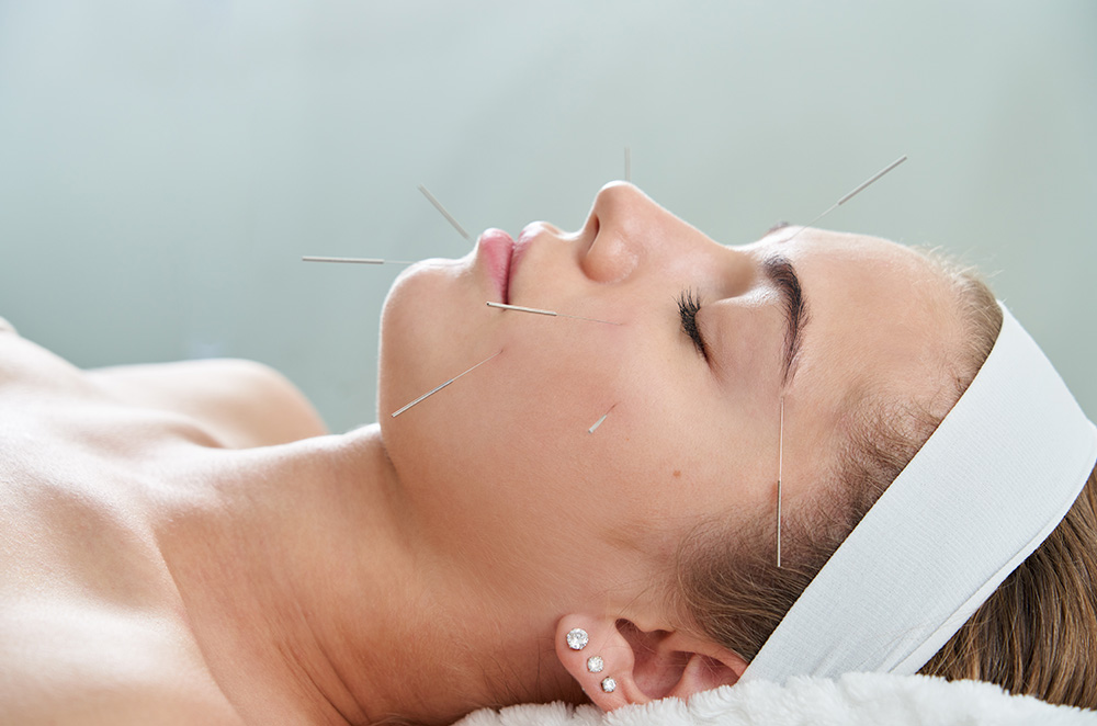 Cómo dejar de fumar con acupuntura Cómo dejar de fumar con acupuntura